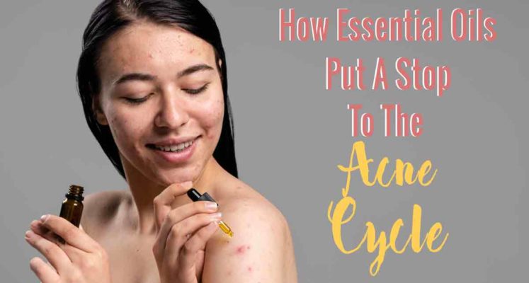 how to use essential oils to stop acne